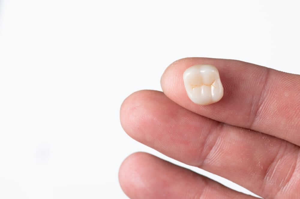 3D齒雕是什麼？