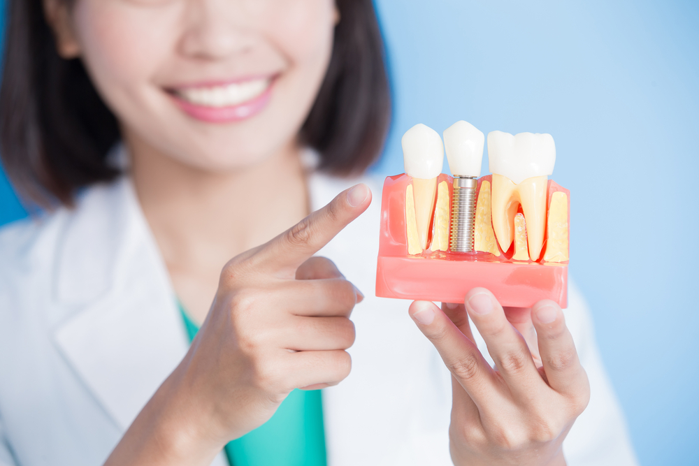 植牙平均壽命可以撐多久？