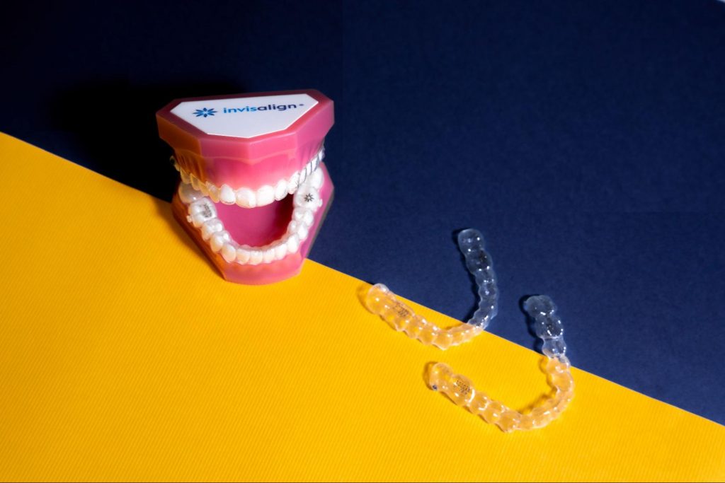 隱形牙套可以矯正上排牙齒突出