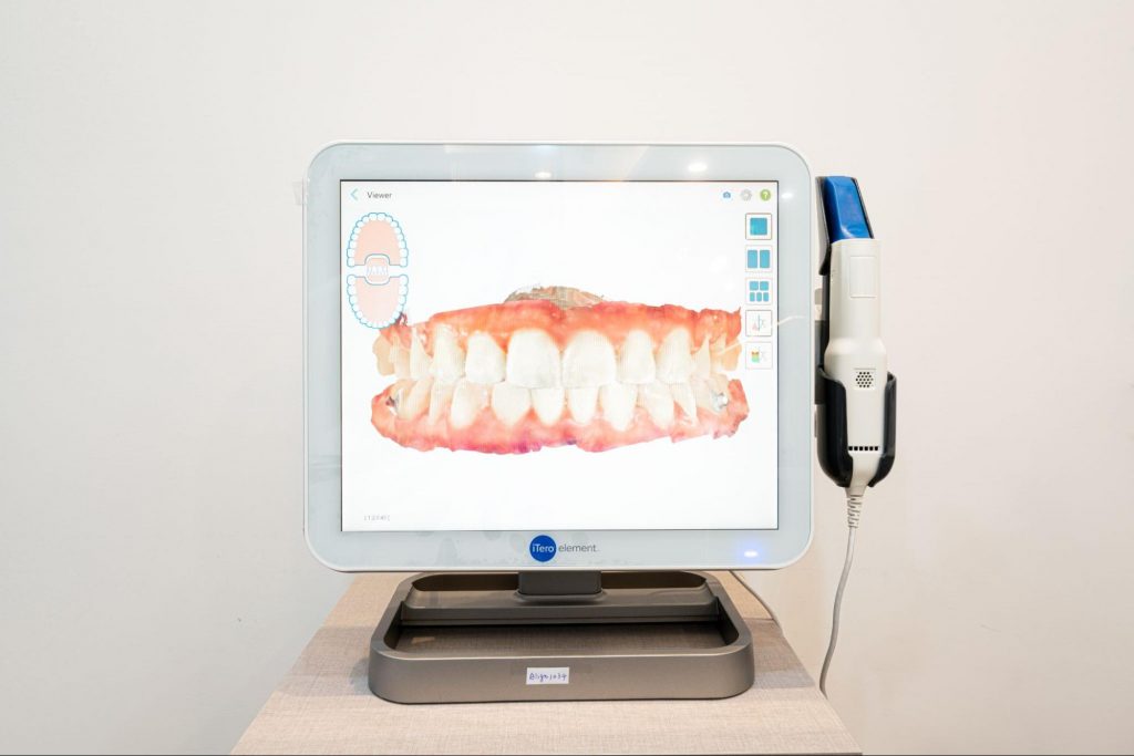 京鼎牙醫採用iTreo口掃機設備進行3D掃描