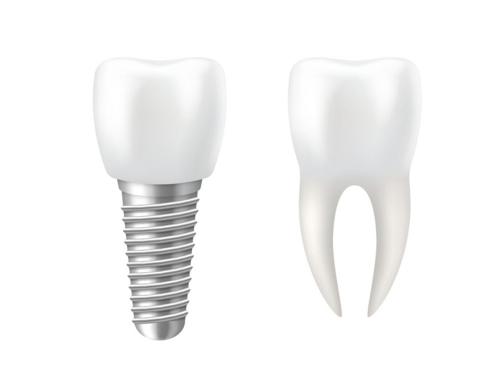 植體是用以取代人工牙根的牙科醫材