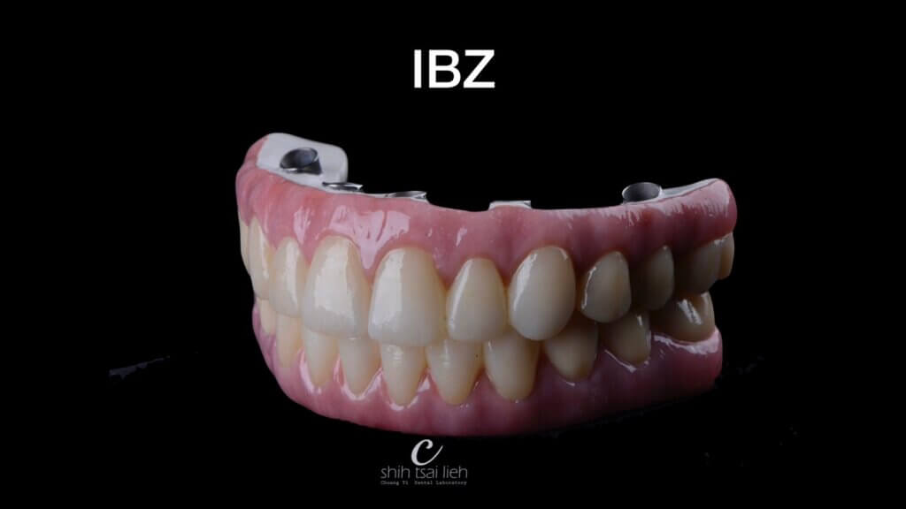 All on 4 植牙假牙：專利設計假牙IBZ (IBO-BioHpp-Zirconia）