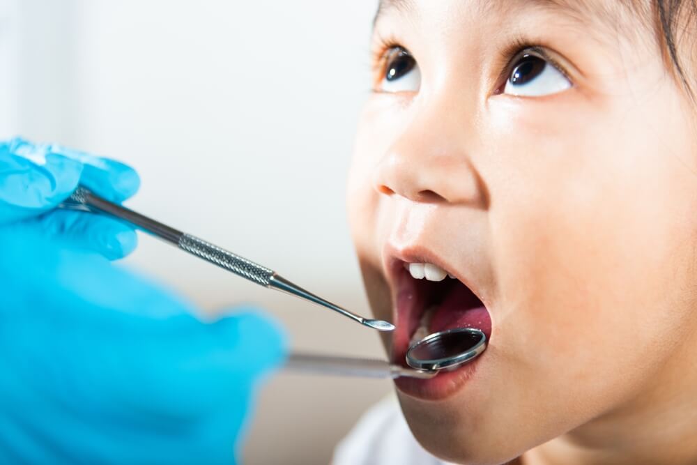 認識乳牙牙套的使用時機與材質差異