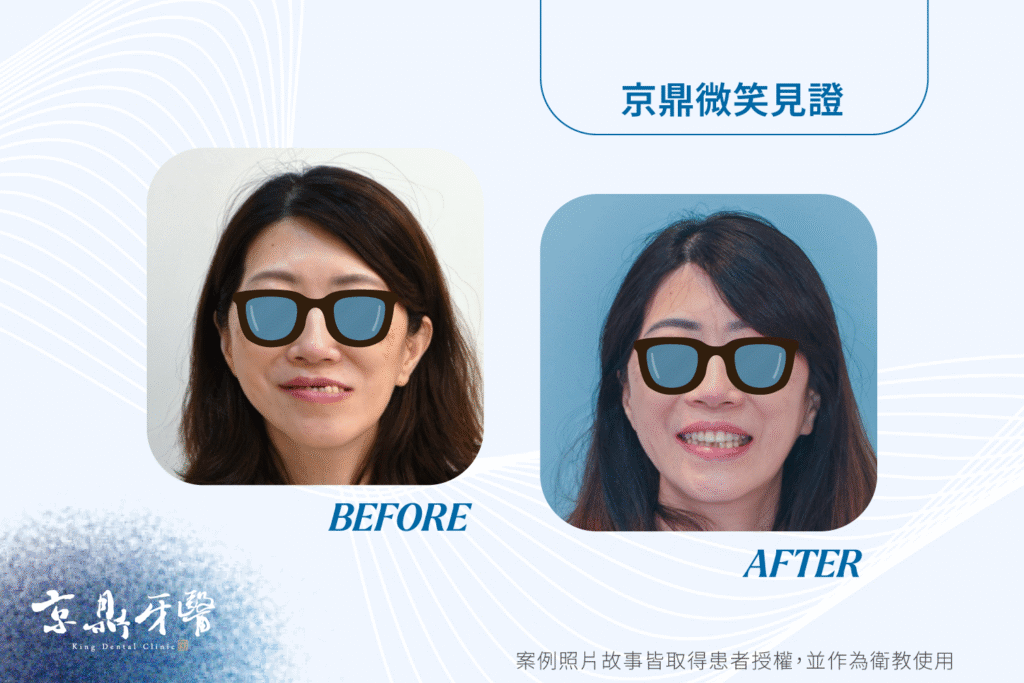 年節來不及