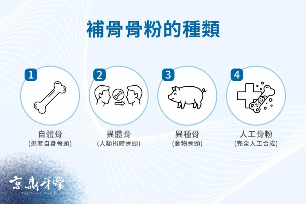 四種骨粉類型:自體骨、異體骨、異種骨、人工骨粉