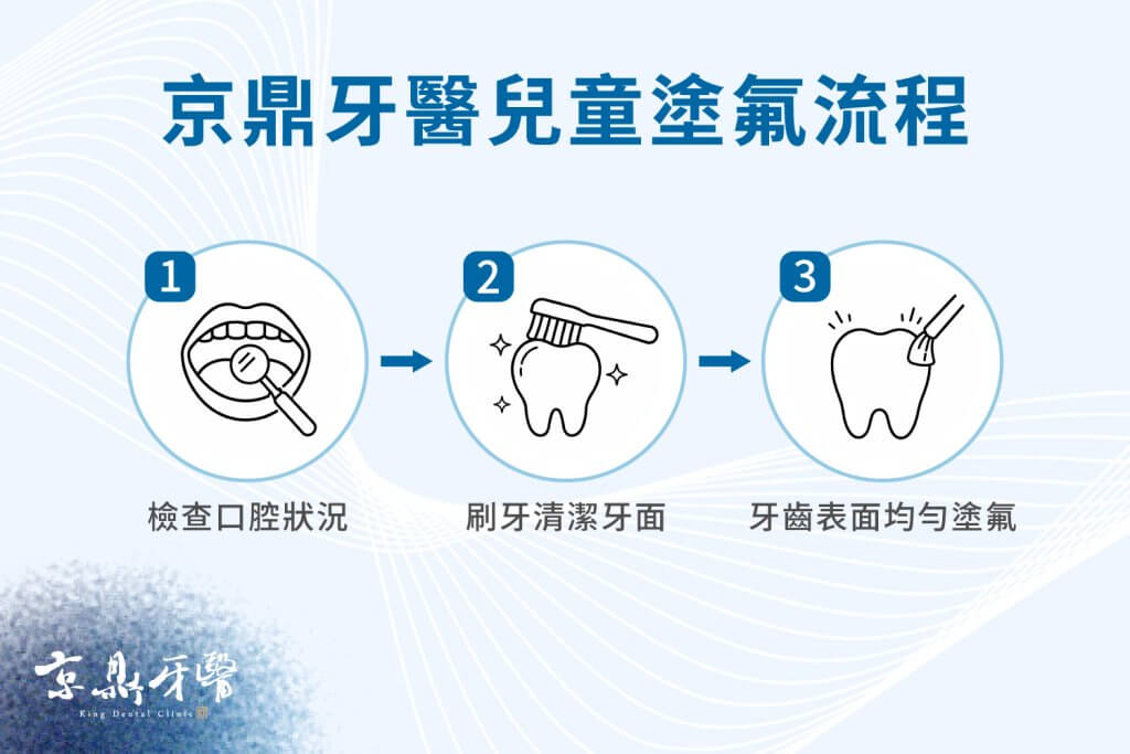 塗氟流程:檢查口腔狀況、刷牙清潔牙面、牙齒表面均勻塗氟